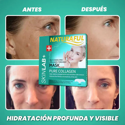✨¡Parches de Colágeno Absorbentes Mágicos para una Piel Radiante y Joven!✨